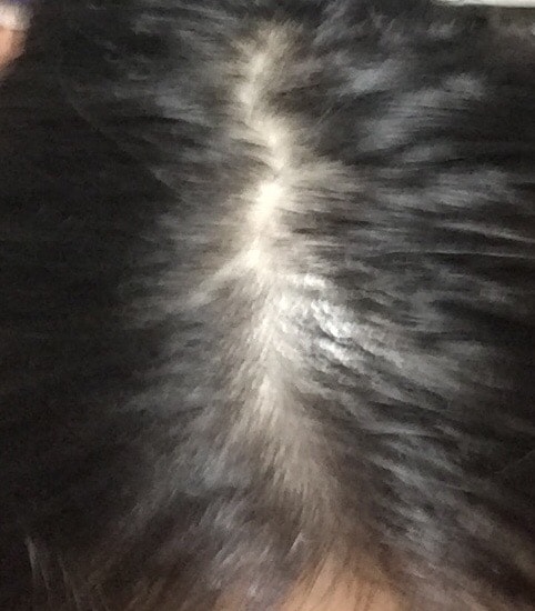 약먹기전에찍은사진입니다