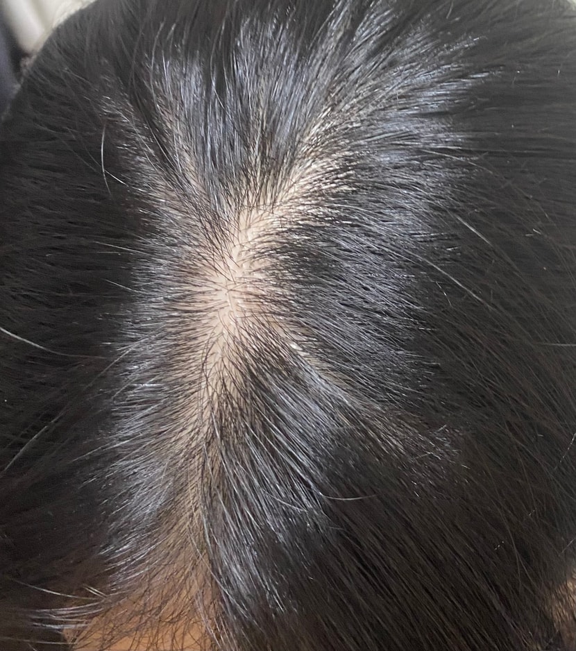 여러 갈래로 갈라지는 가르마ㅜㅜㅜ하