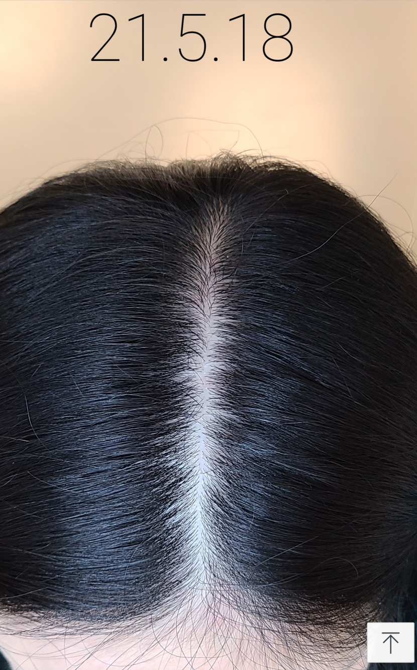 약복용 6개월 후