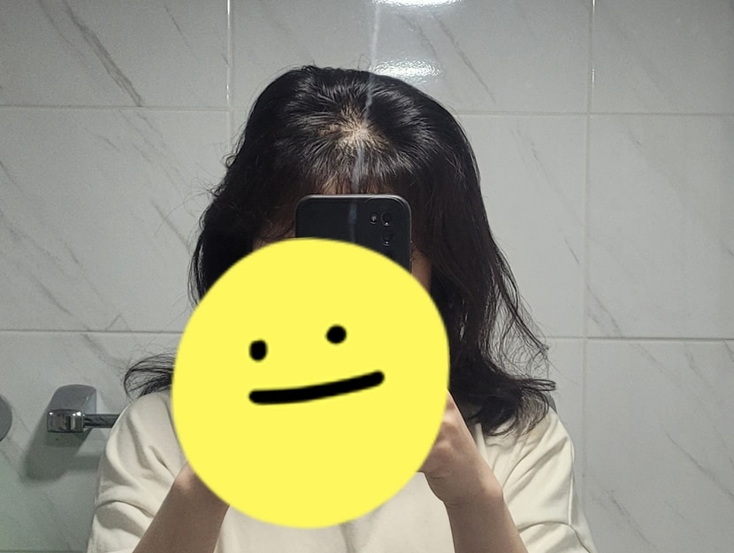 치료전