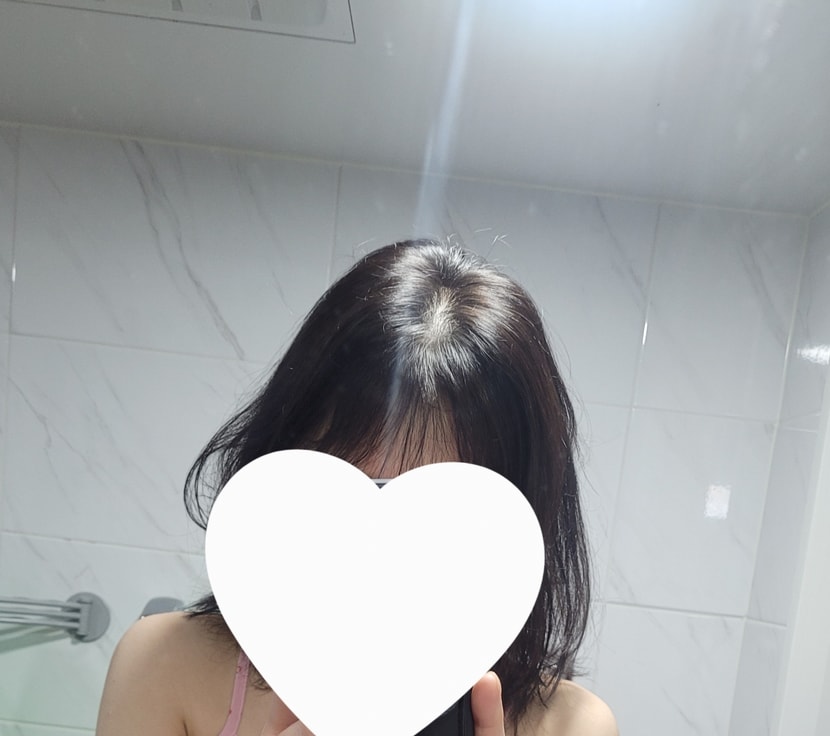 처방약 12일째 (머리자름)