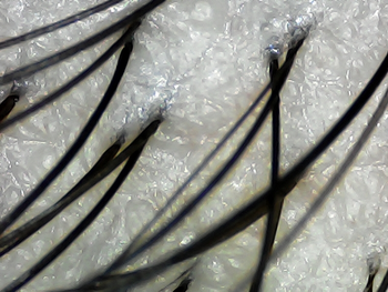 3. 뒷통수쪽 머리