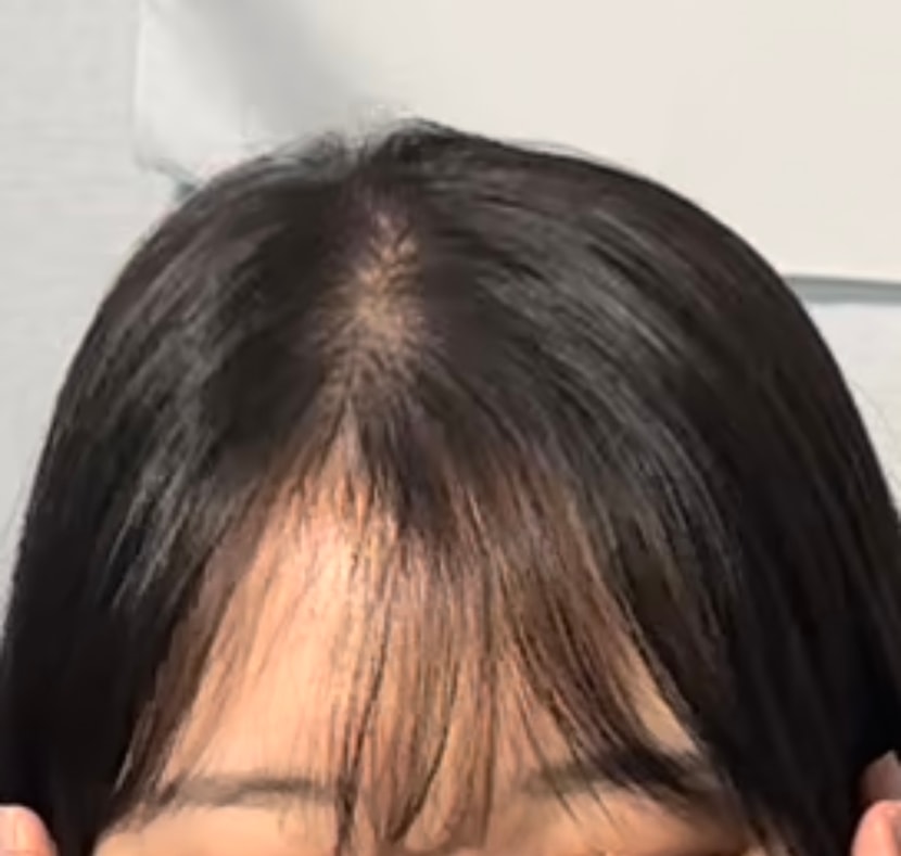 지인이 찍어준사진 (치료전)