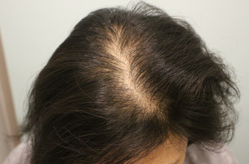 수술 전 모습이예요