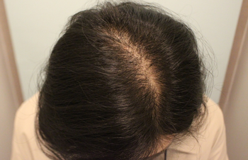 이제 1년 지난 모습입니다