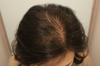 8개월 째 모습이구요