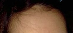 [女性脱发] prosca 5个月服用后记
