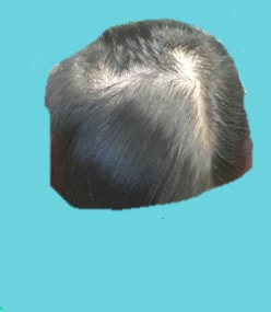 수술전 10월