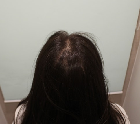 수술 전