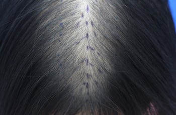 수술전이요 ㅜㅜ