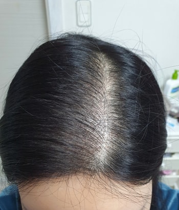 15일차