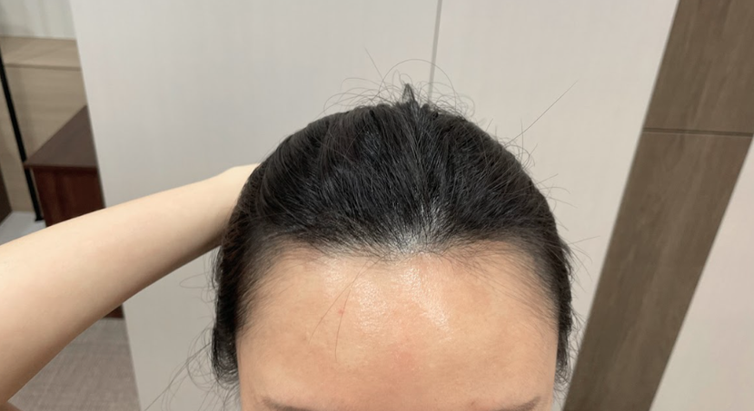 주사 시술 전