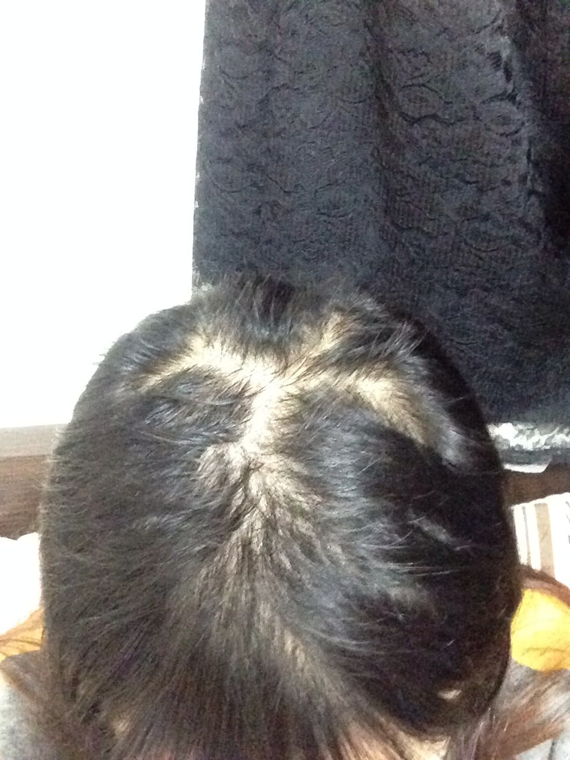170일 현재