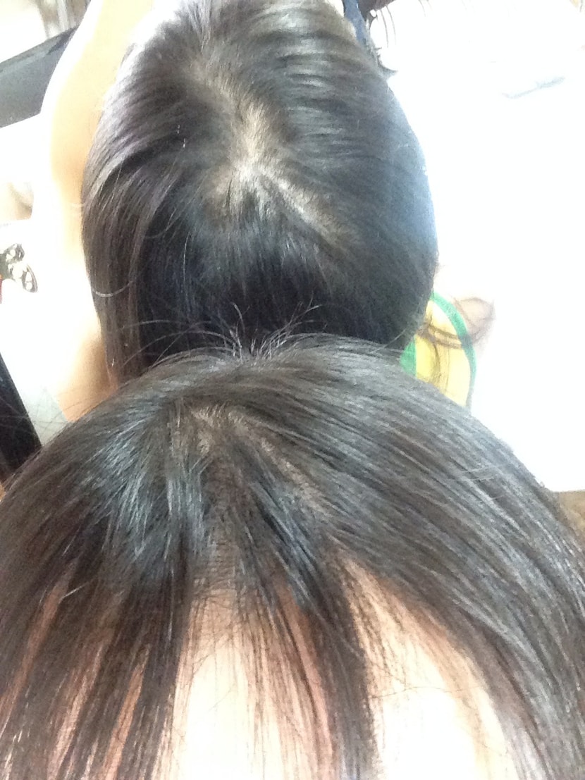 이식전