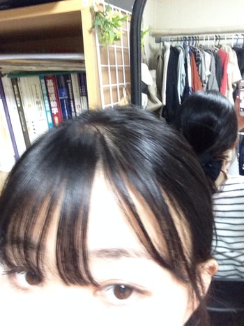 이식 전 머리 묶은 것