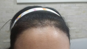 네달