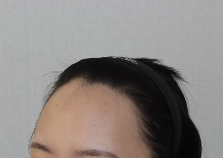 전