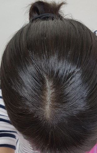 위에서 찍은 사진