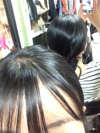 이식 전 밑으로 머리 묶은 사진