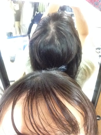 이식 후 반묶음 사진 위에서 본 것