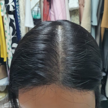 5개월차