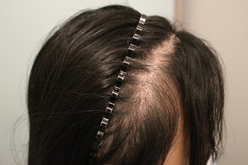 현재 4개월 경과 입니다.