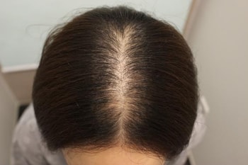 수술전에 찍었습니다
