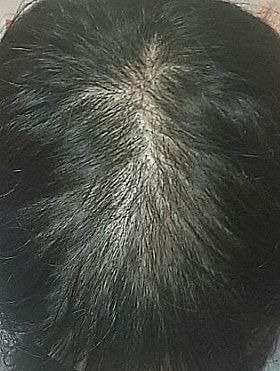 한달째 사진입니다.