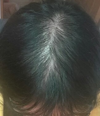 현재 5개월째 입니다. 조금씩 자라나는게 보이네요 ㅎㅎ 아직한참은 더 있어야 할듯해여 