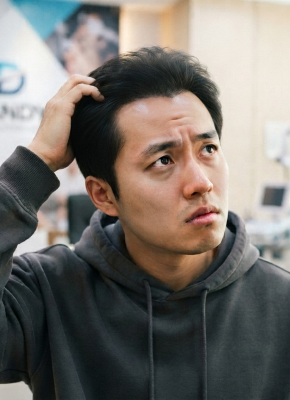 벌써 하얗게 비치는 정수리🫠 모발이식 20대에 해도 괜찮을까?