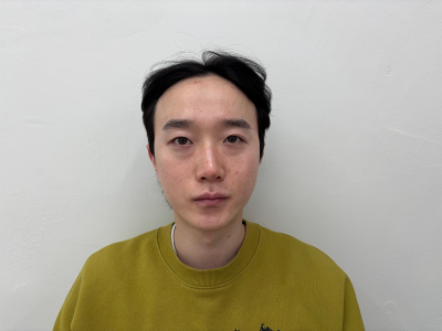  4년만에 눈이랑 코 재수술 했습니다