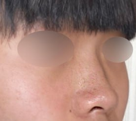 기능미용코 하면 베리굿이네요