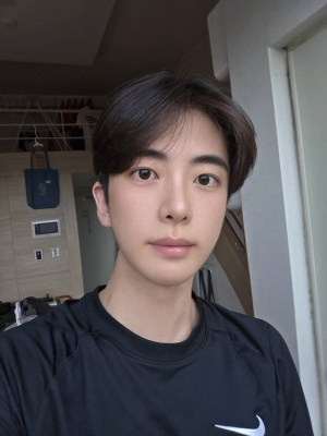 티 안나게 잘된 남자 윤곽,눈,코,줄기세포까지 받고 사람 됨ㅎㅎ (디에이)