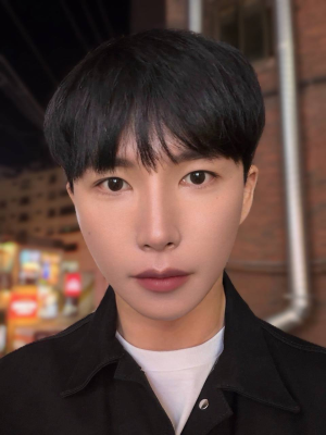 동안 됐다는 말 많이 들어요. 디에이 눈,수직미니거상,눈매이마거상,줄기세포 남자 후기.
