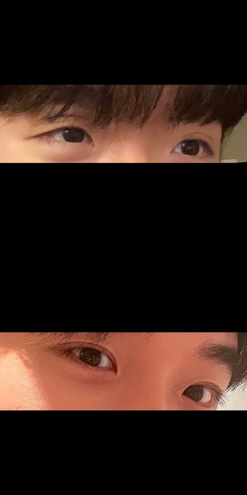 mrtnef님의 시술후기