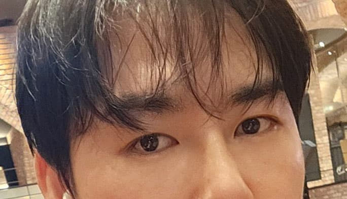 아배마리아님의 시술후기