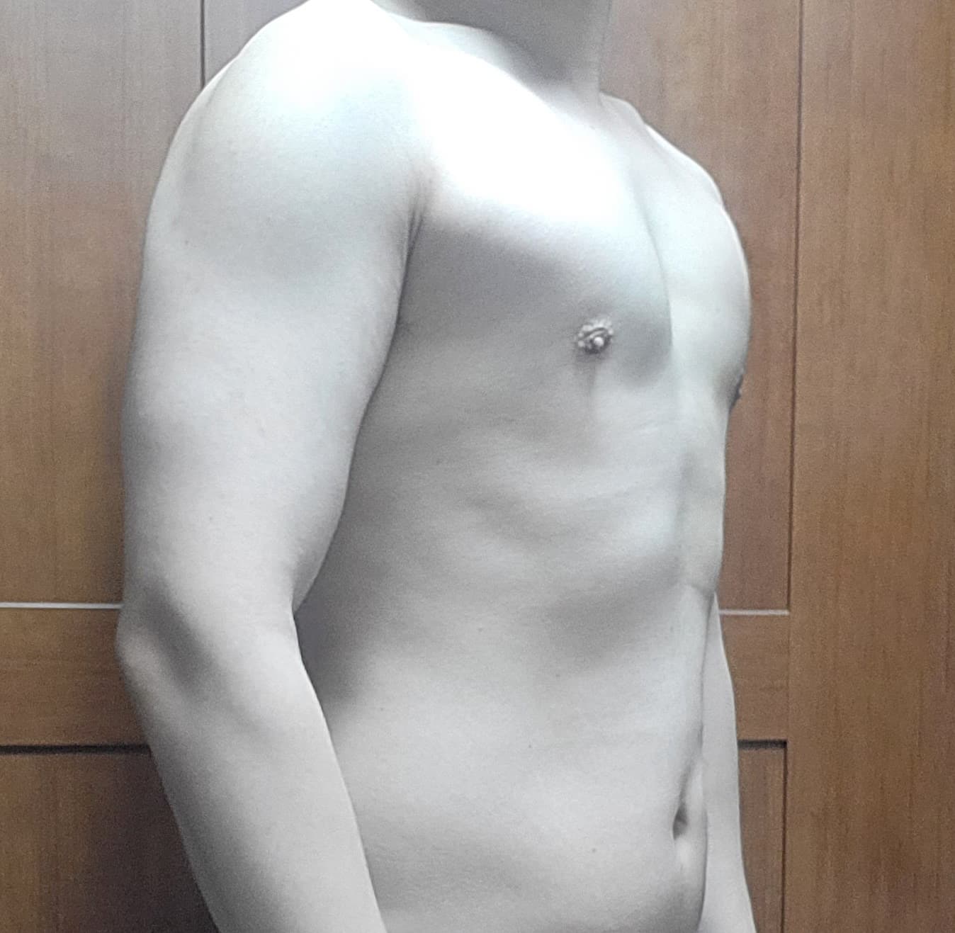 가을하느을님의 시술후기