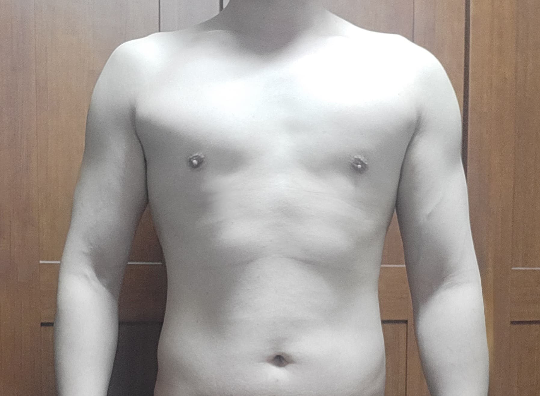 가을하느을님의 시술후기
