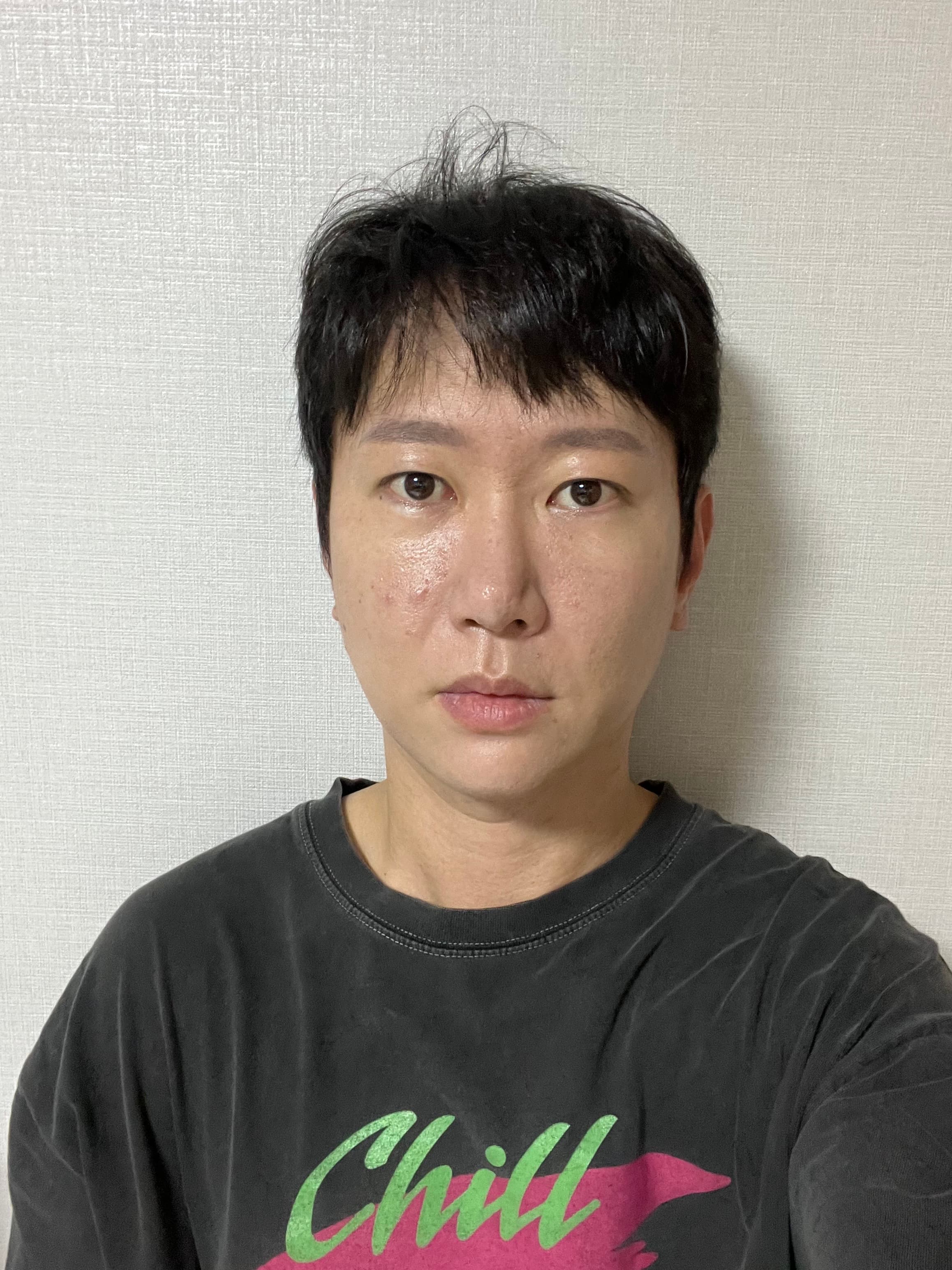 이으덪님의 시술후기