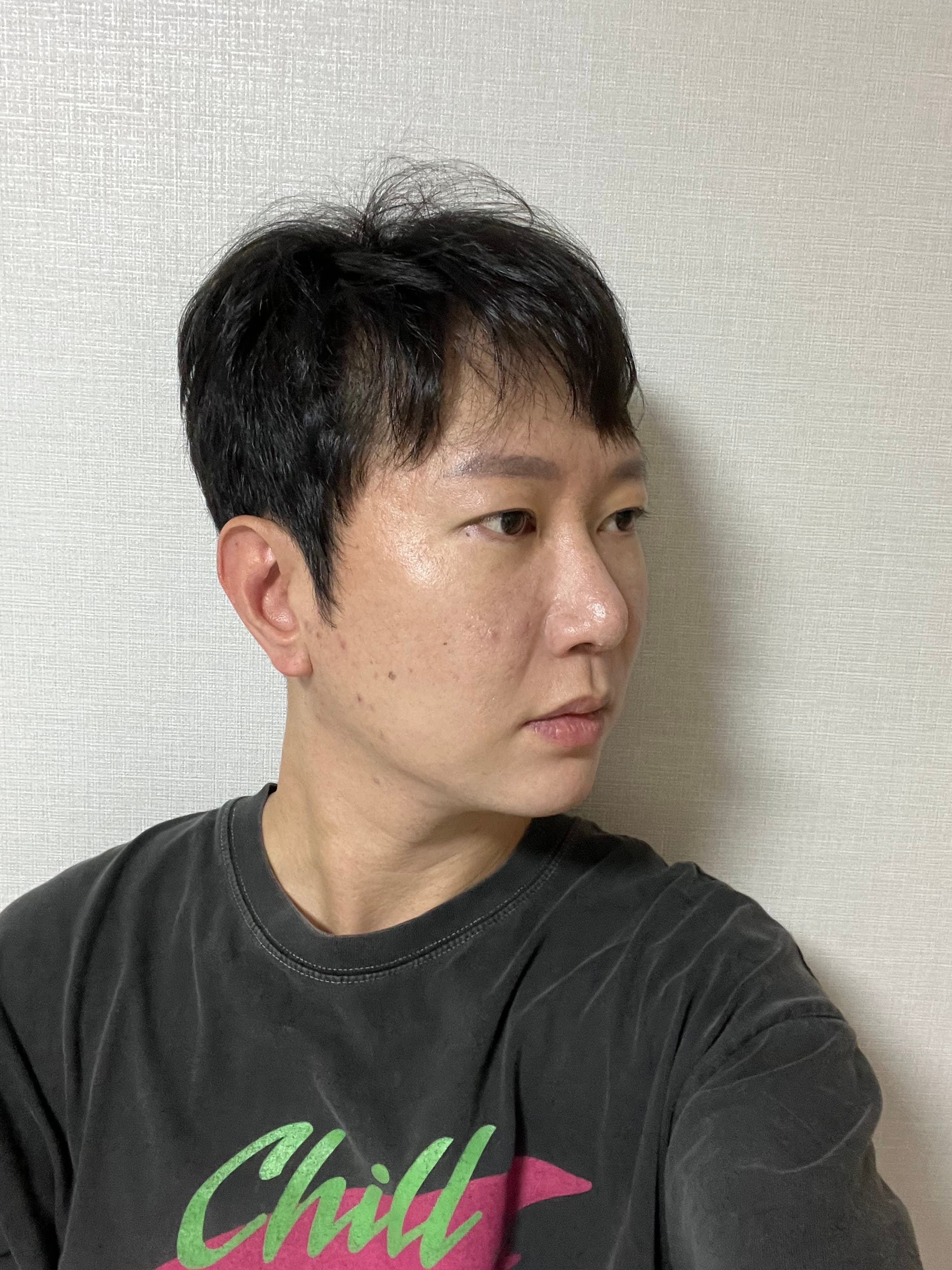 이으덪님의 시술후기