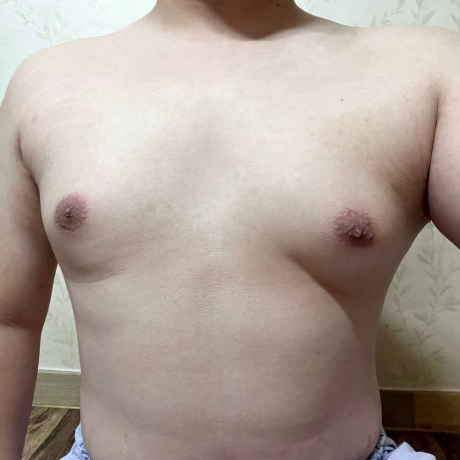 클쑤마쑹님의 시술후기