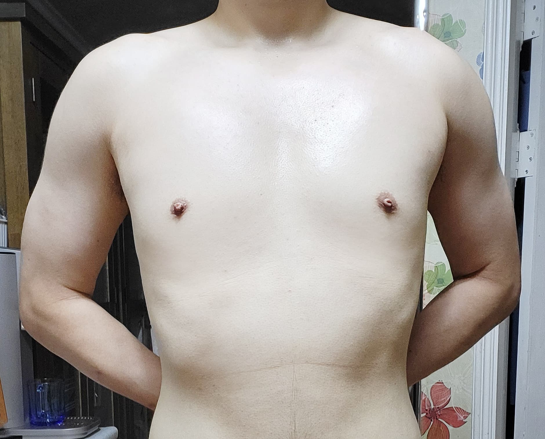 솔솔바람이님의 시술후기