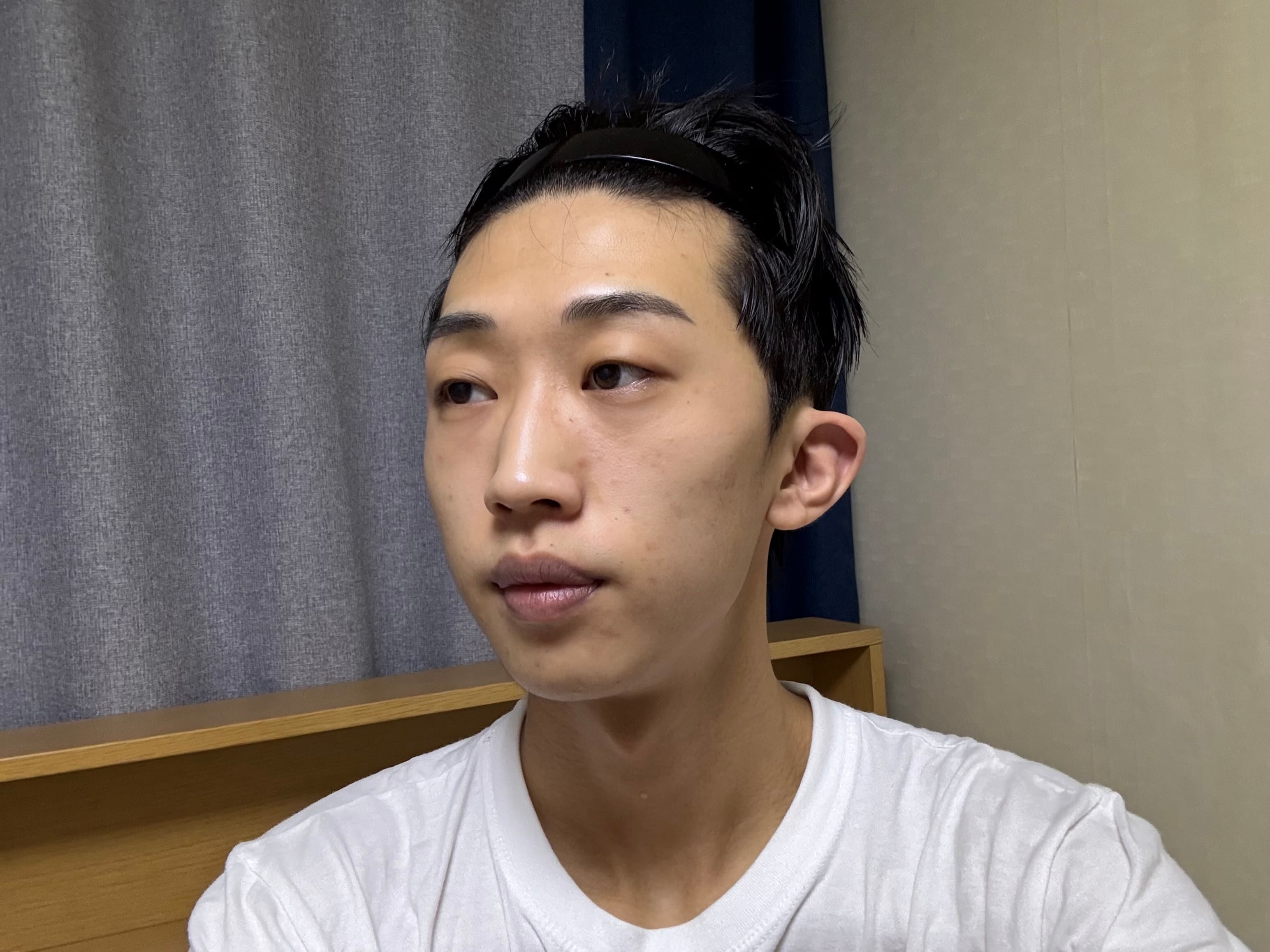 날라다녈님의 시술후기