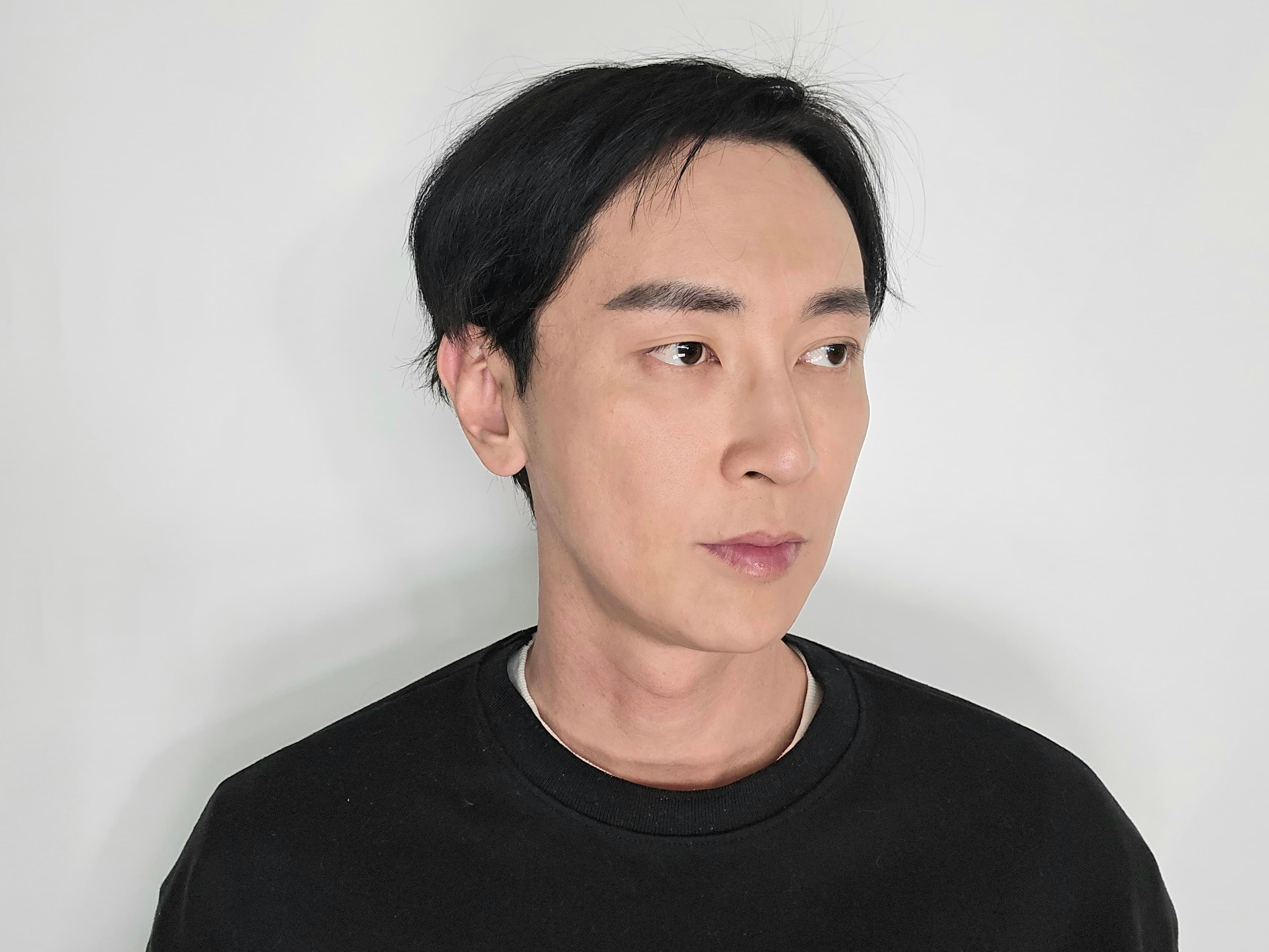 무냐님의 시술후기