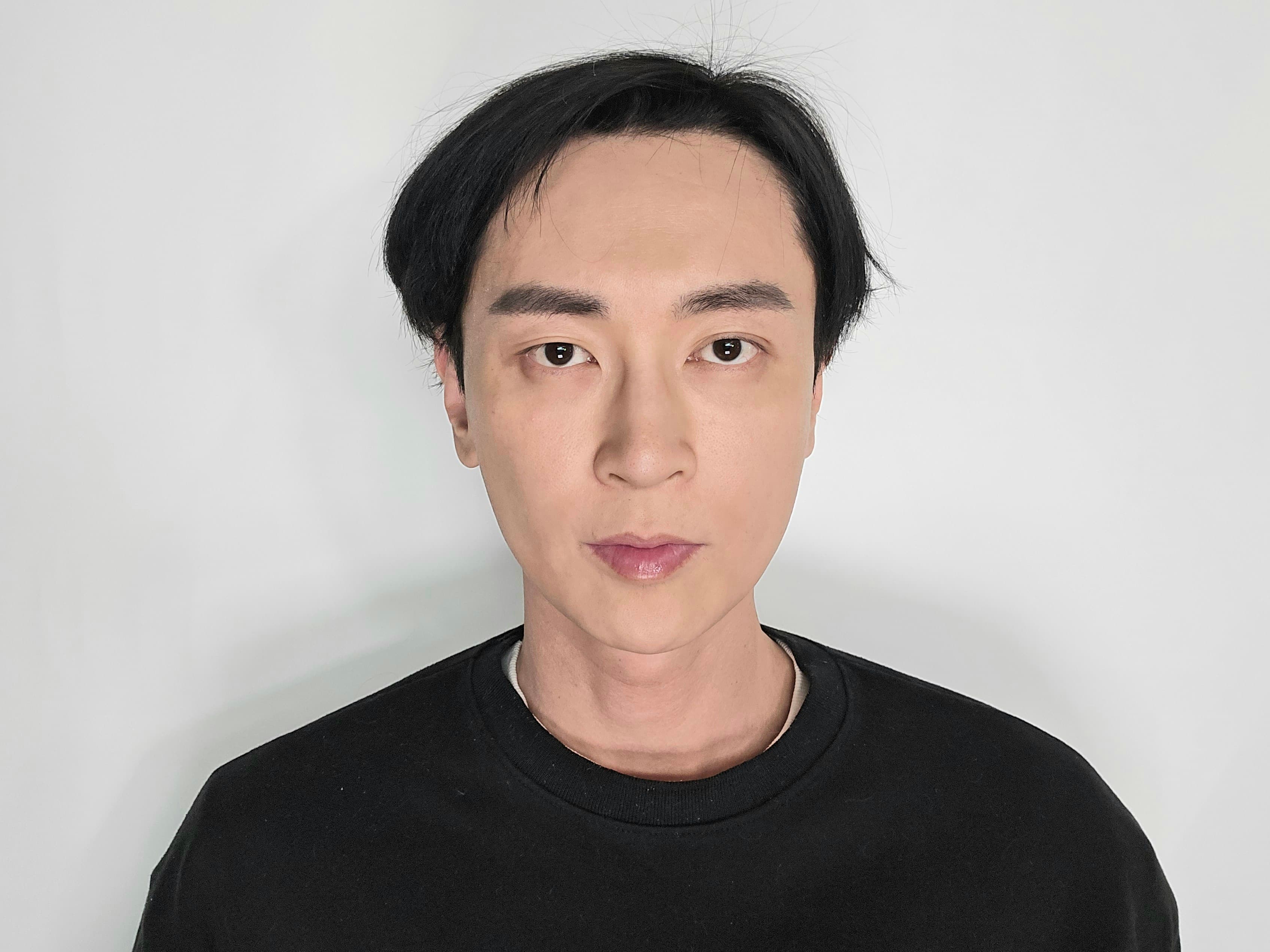 무냐님의 시술후기