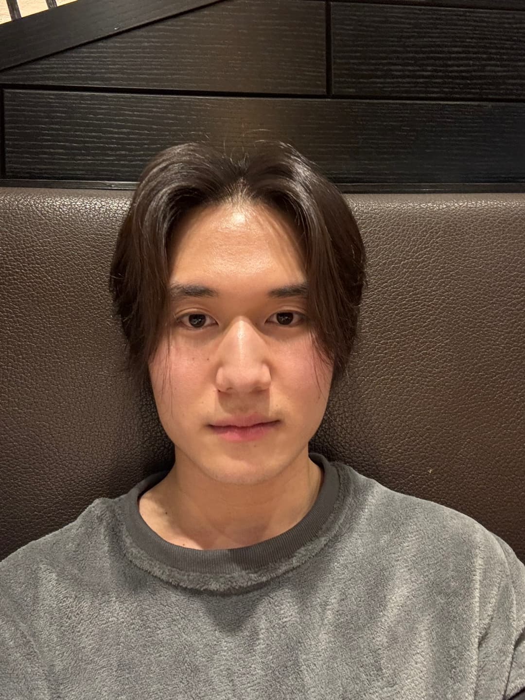 소희댱님의 시술후기