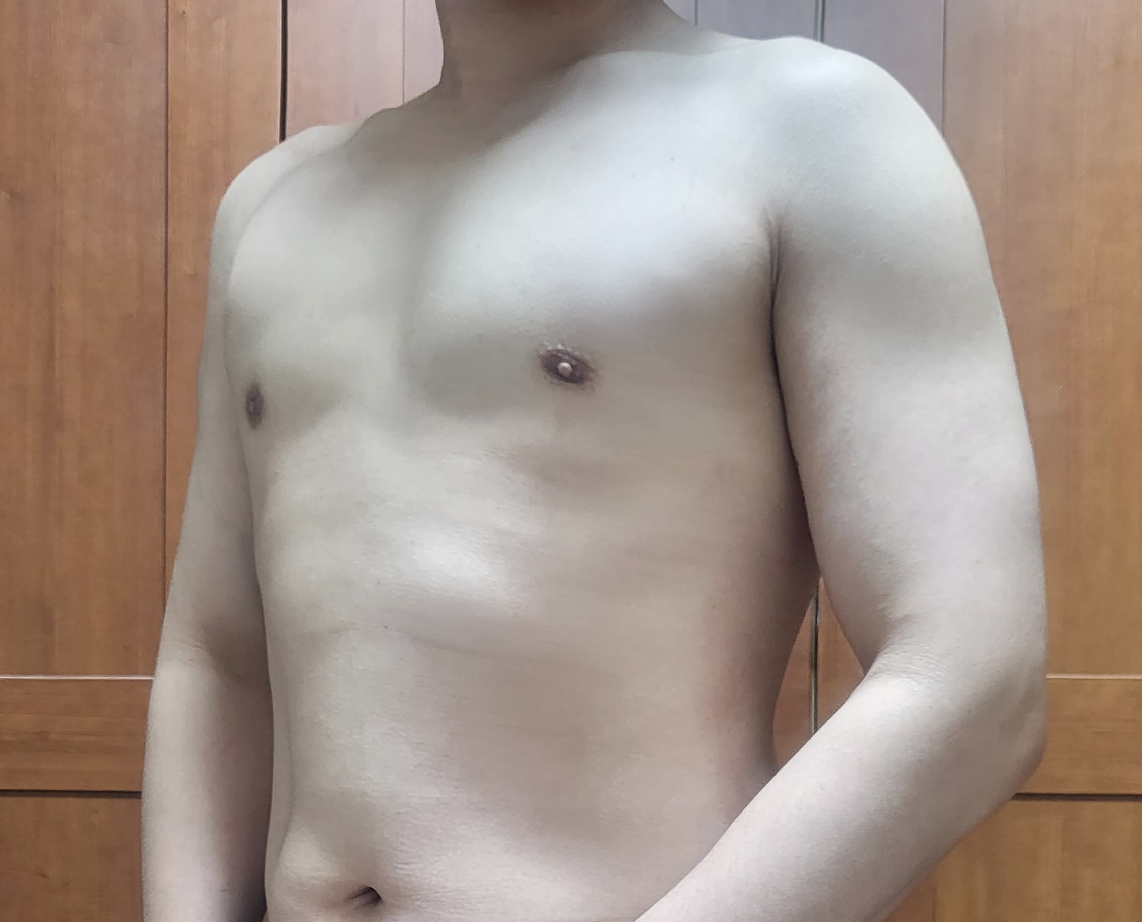 가을하느을님의 시술후기