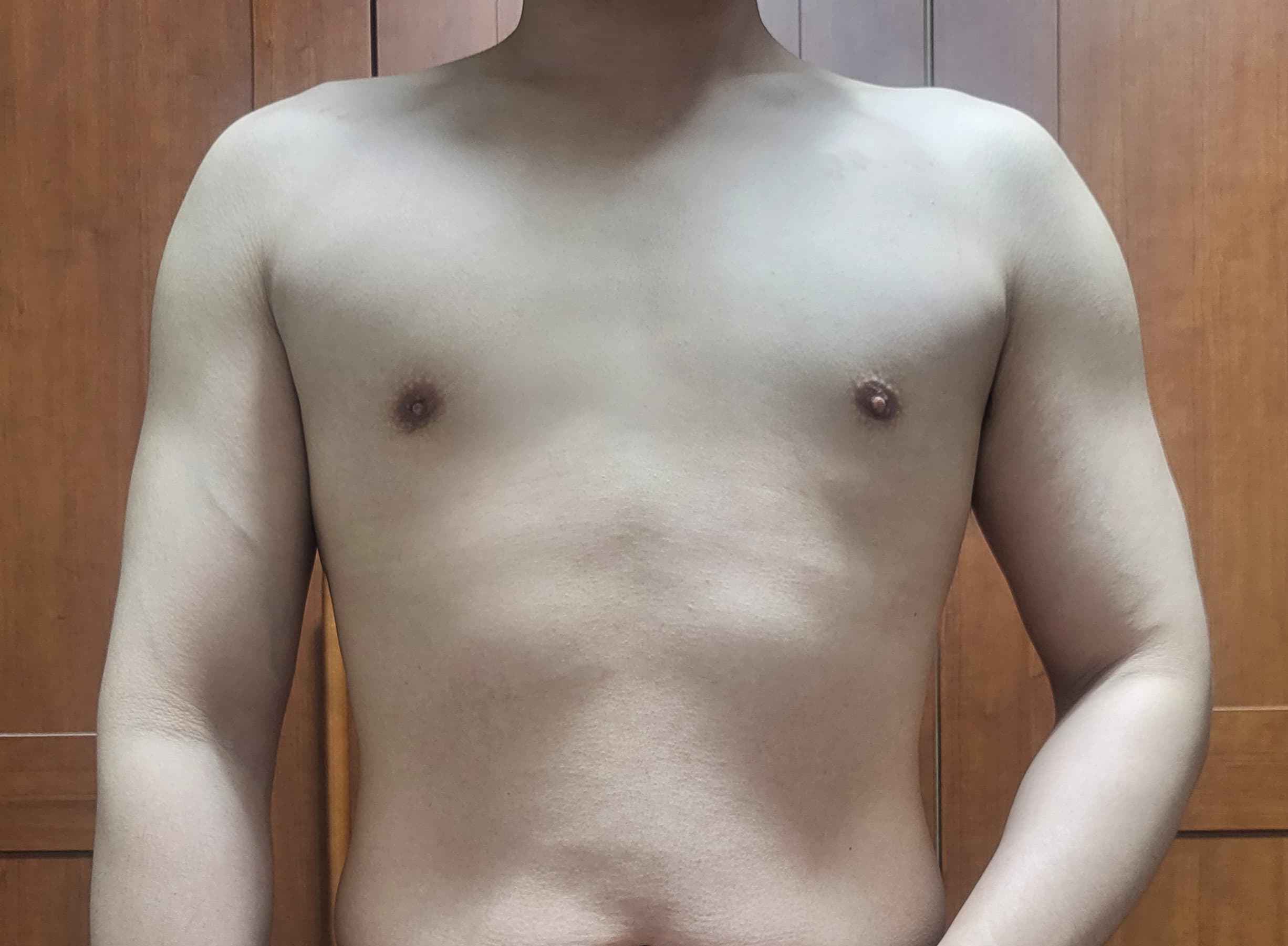 가을하느을님의 시술후기