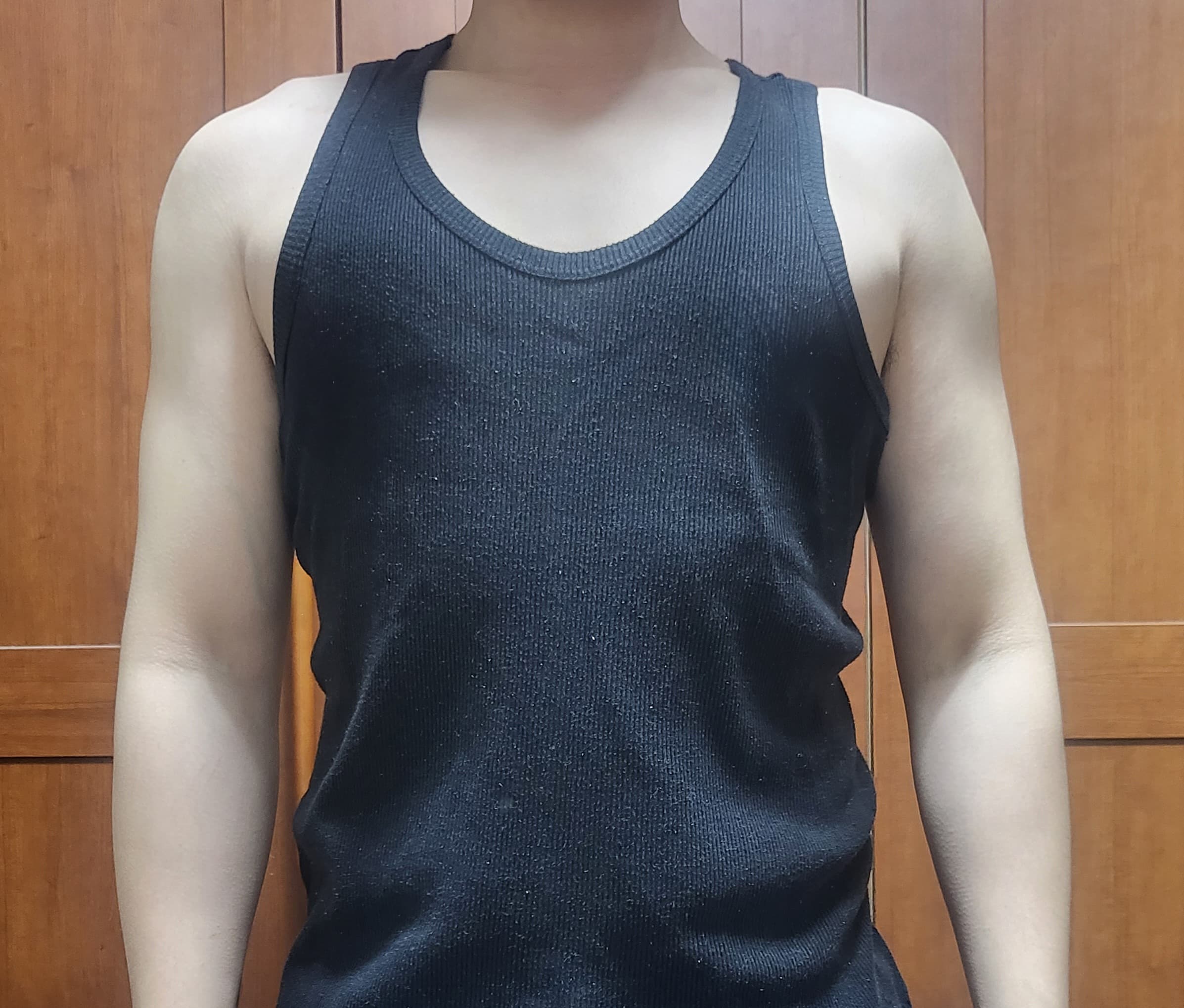 가을하느을님의 시술후기