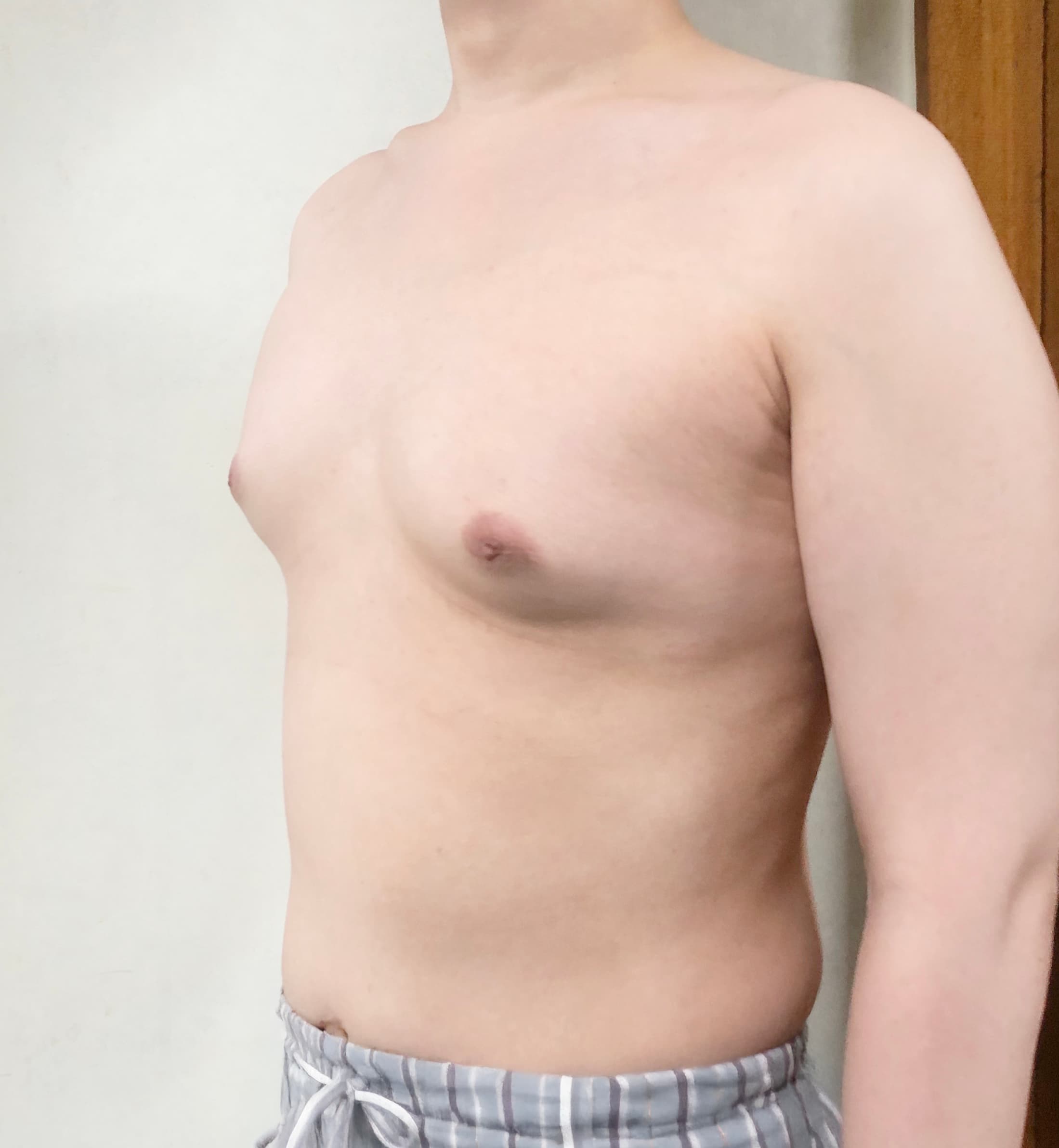 라랄르라님의 시술후기